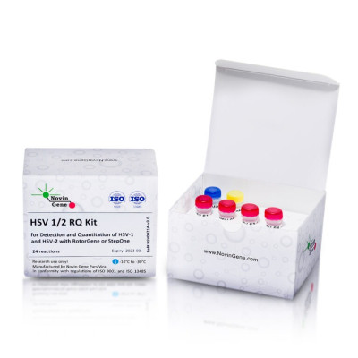 HSV 1 and 2 Detection and Quantitation Kit